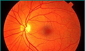 Diabetic Eye Examinations in Zanesville, OH | Zanesville Vision Care